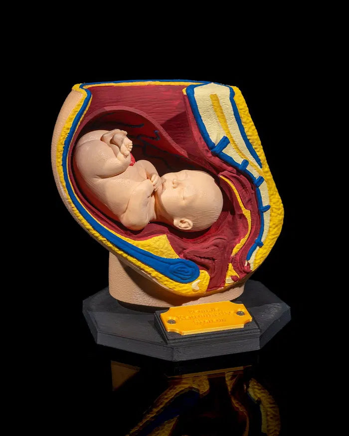Female_Reproductive_System_2_d31caac73b